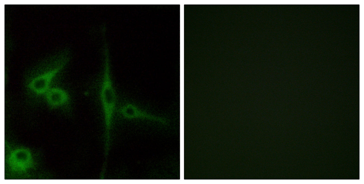 ETL Rabbit Polyclonal Antibody