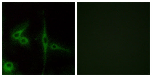 ETL Rabbit Polyclonal Antibody