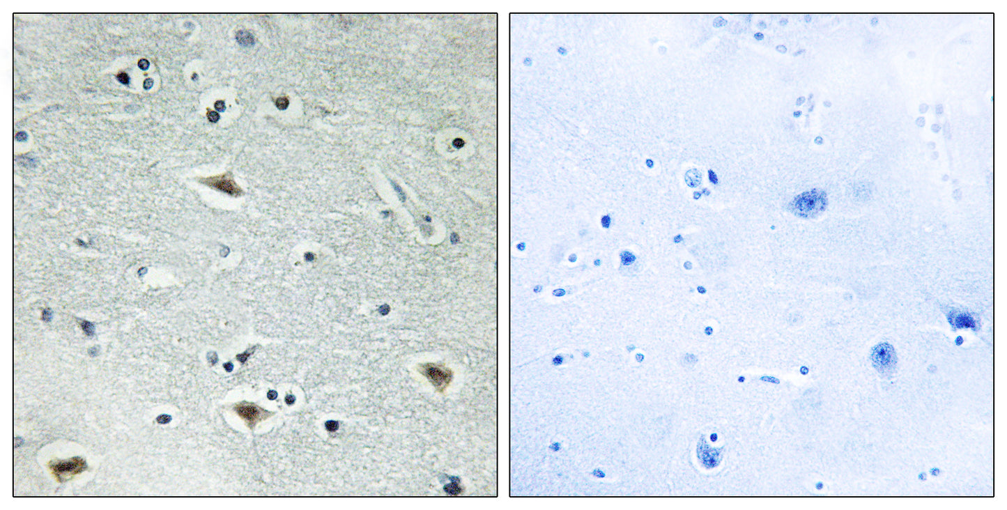 ETO-2 Rabbit Polyclonal Antibody
