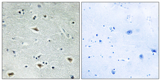 ETO-2 Rabbit Polyclonal Antibody