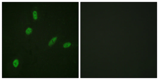 ETS1 Rabbit Polyclonal Antibody