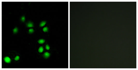 Exo1 Rabbit Polyclonal Antibody