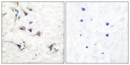 Ezrin Rabbit Polyclonal Antibody