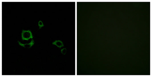 Factor XIII B Rabbit Polyclonal Antibody