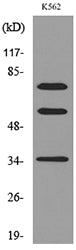 FAF1 Rabbit Polyclonal Antibody