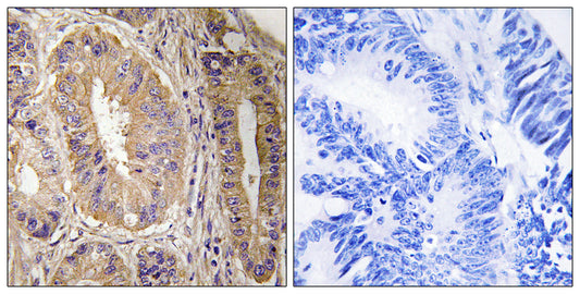FAK Rabbit Polyclonal Antibody