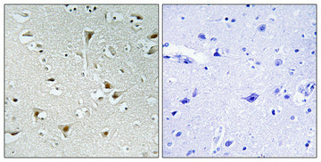 FAM111B Rabbit Polyclonal Antibody