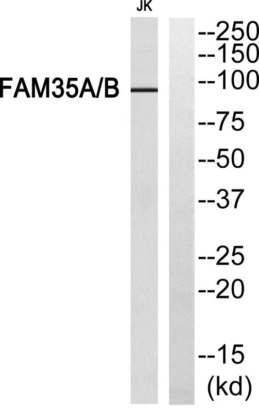 FAM35A/B Rabbit Polyclonal Antibody