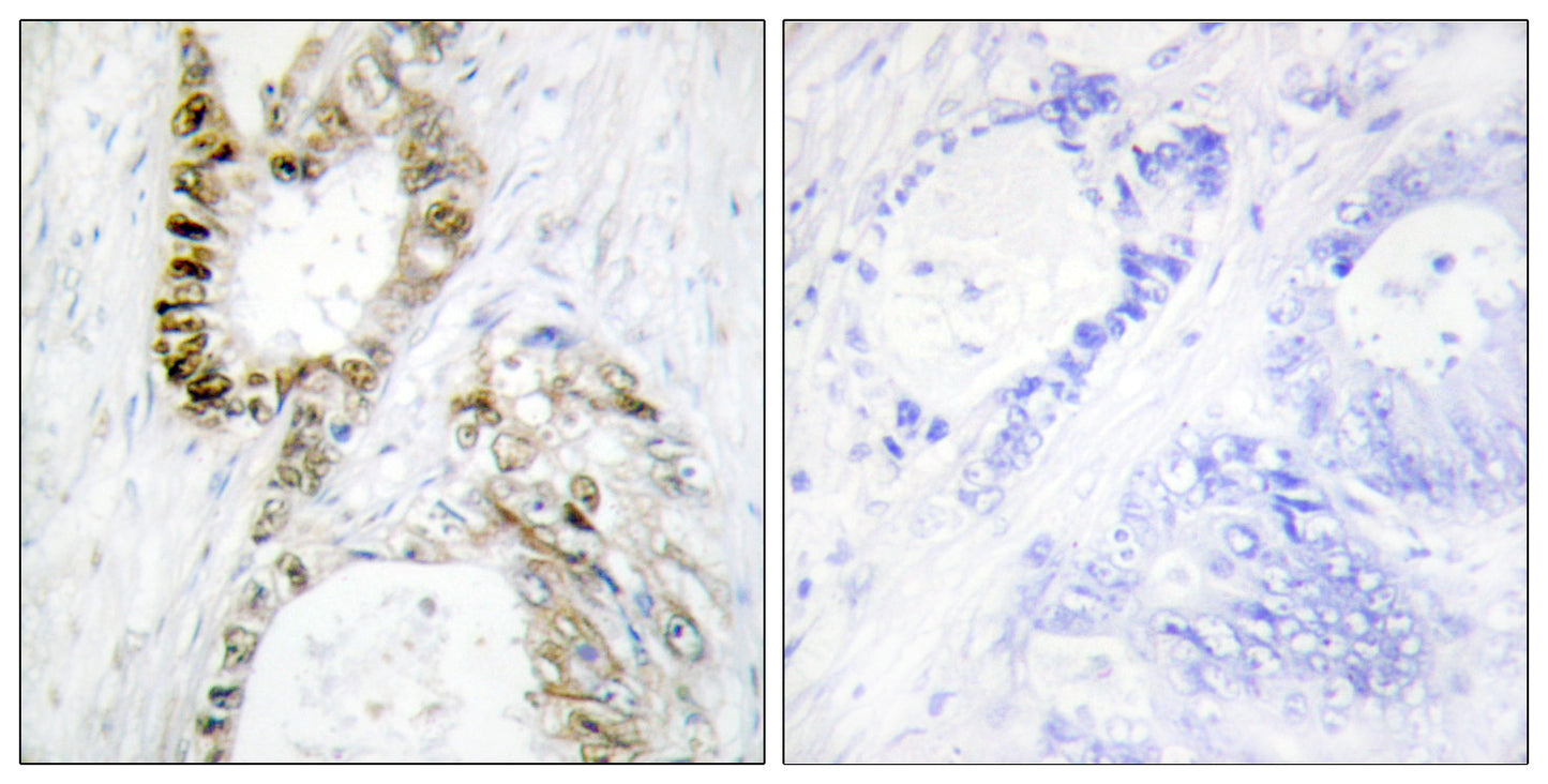 FANCA Rabbit Polyclonal Antibody