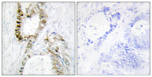 FANCA Rabbit Polyclonal Antibody
