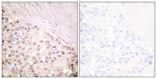 FANCD2 Rabbit Polyclonal Antibody
