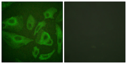 FAS Rabbit Polyclonal Antibody