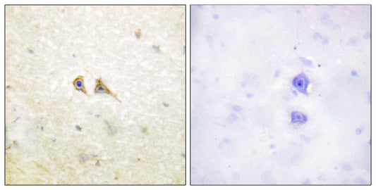 FAS-L Rabbit Polyclonal Antibody