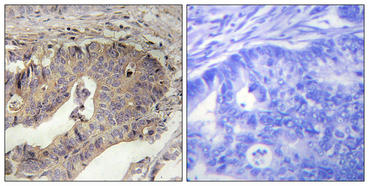 FBN1 Rabbit Polyclonal Antibody
