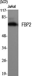FBP2 Rabbit Polyclonal Antibody