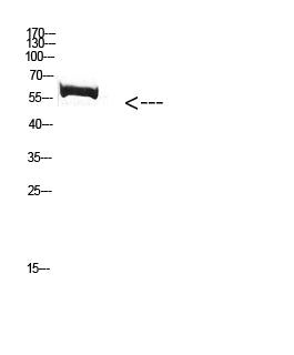 FBXO7 Rabbit Polyclonal Antibody