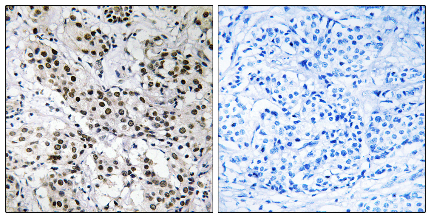Fe65L Rabbit Polyclonal Antibody