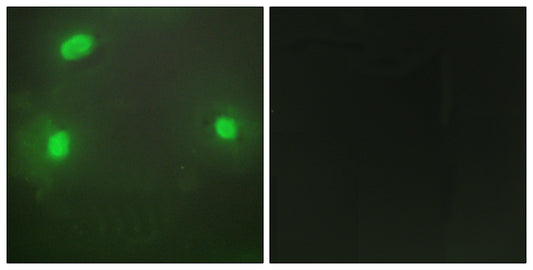 FEN-1 Rabbit Polyclonal Antibody