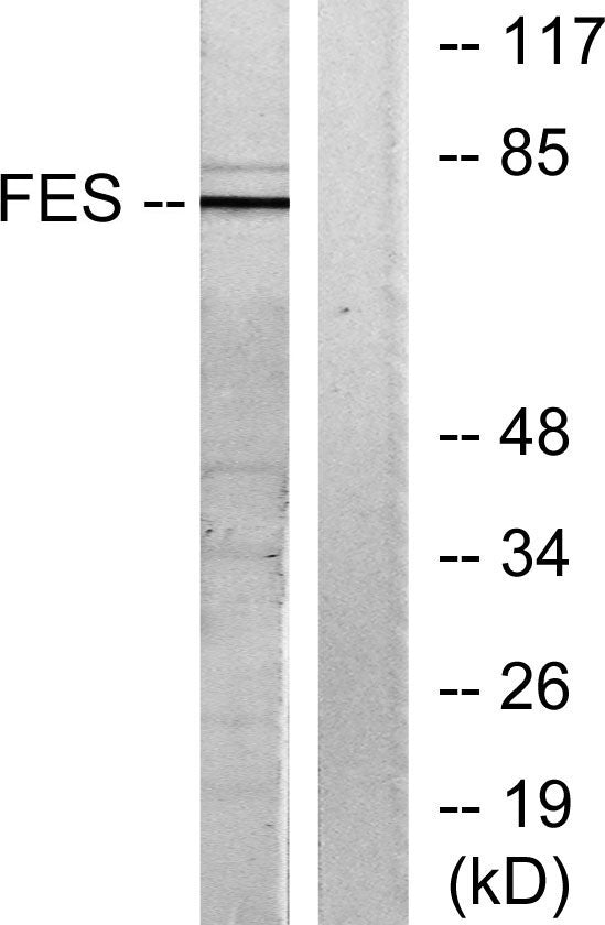 Fes Rabbit Polyclonal Antibody