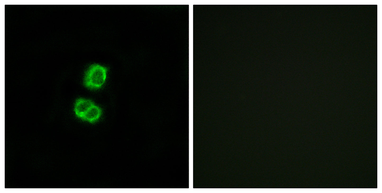 FGF-22 Rabbit Polyclonal Antibody