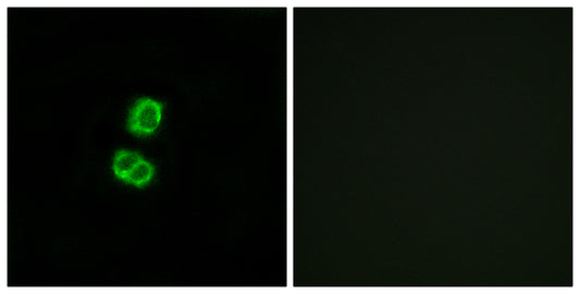 FGF-22 Rabbit Polyclonal Antibody