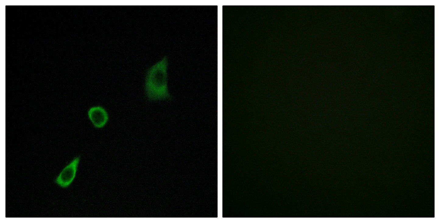 FGF-23 Rabbit Polyclonal Antibody