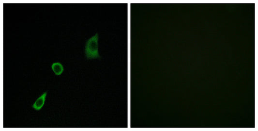 FGF-23 Rabbit Polyclonal Antibody
