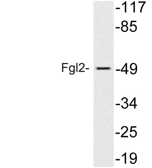 Fgl2 Rabbit Polyclonal Antibody