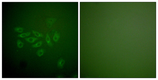 Fhit Rabbit Polyclonal Antibody