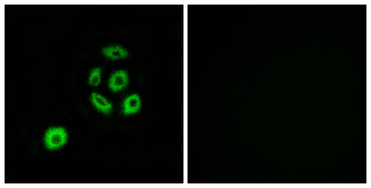 Fibulin-2 Rabbit Polyclonal Antibody