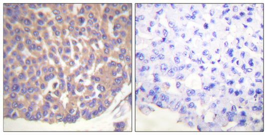 Filamin 1 Rabbit Polyclonal Antibody