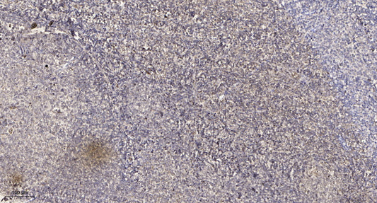FKBP1B  Rabbit Polyclonal Antibody