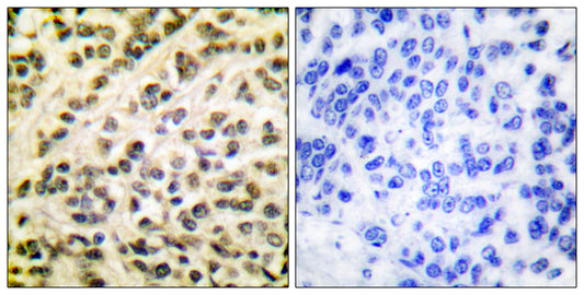 Fli-1 Rabbit Polyclonal Antibody
