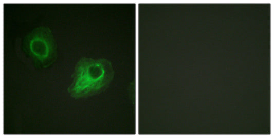 Flk-1/Flt-4 Rabbit Polyclonal Antibody
