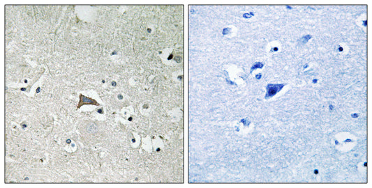 Flt-1 Rabbit Polyclonal Antibody