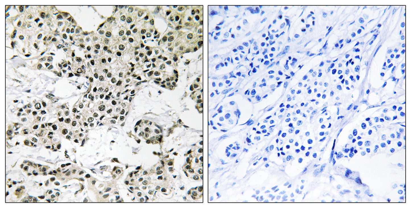 FMIP Rabbit Polyclonal Antibody