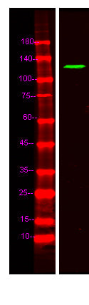 FNBP4 Rabbit Polyclonal Antibody