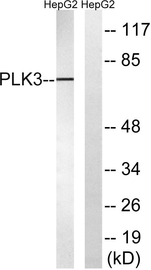 Fnk Rabbit Polyclonal Antibody
