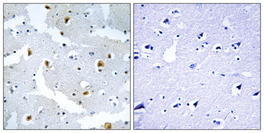 Formin 2 Rabbit Polyclonal Antibody