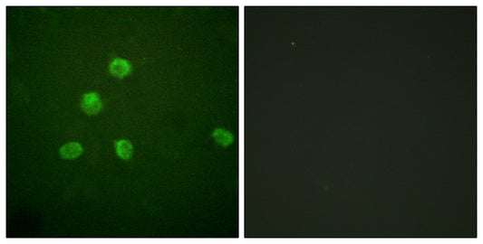 Fos B Rabbit Polyclonal Antibody