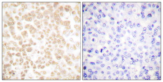 FOSL2 Rabbit Polyclonal Antibody