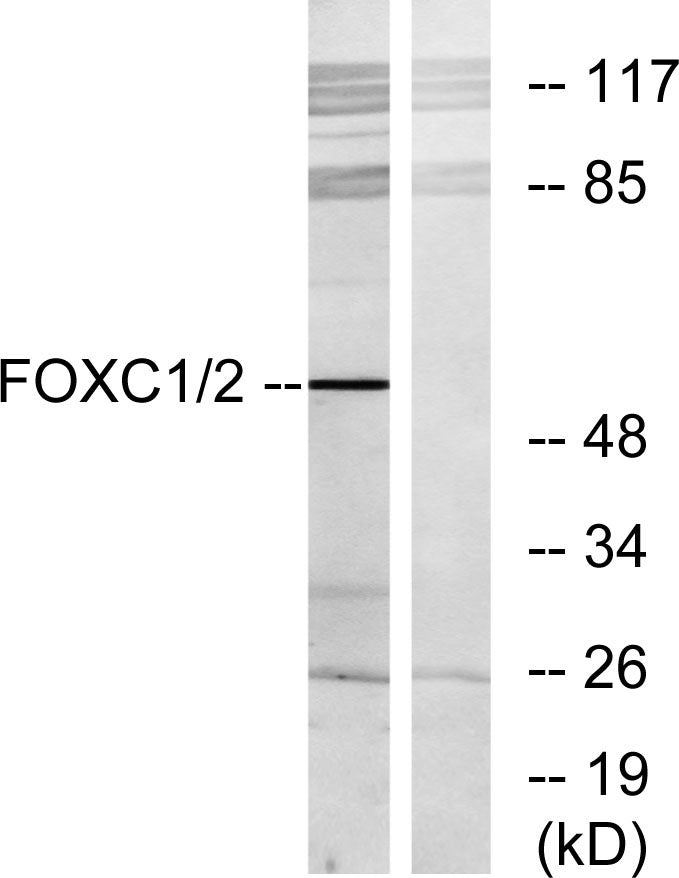 FoxC1/2 Rabbit Polyclonal Antibody