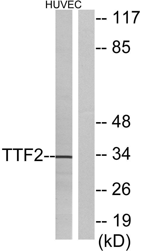 FoxE1 Rabbit Polyclonal Antibody