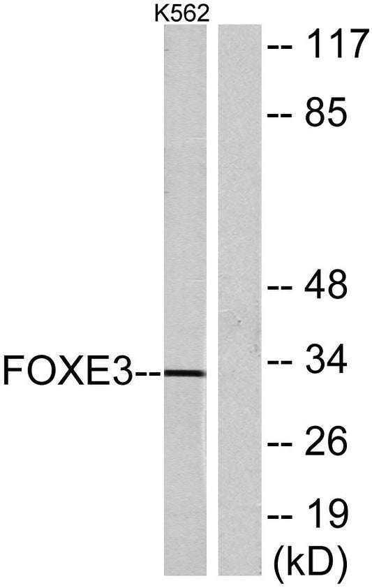 FoxE3 Rabbit Polyclonal Antibody