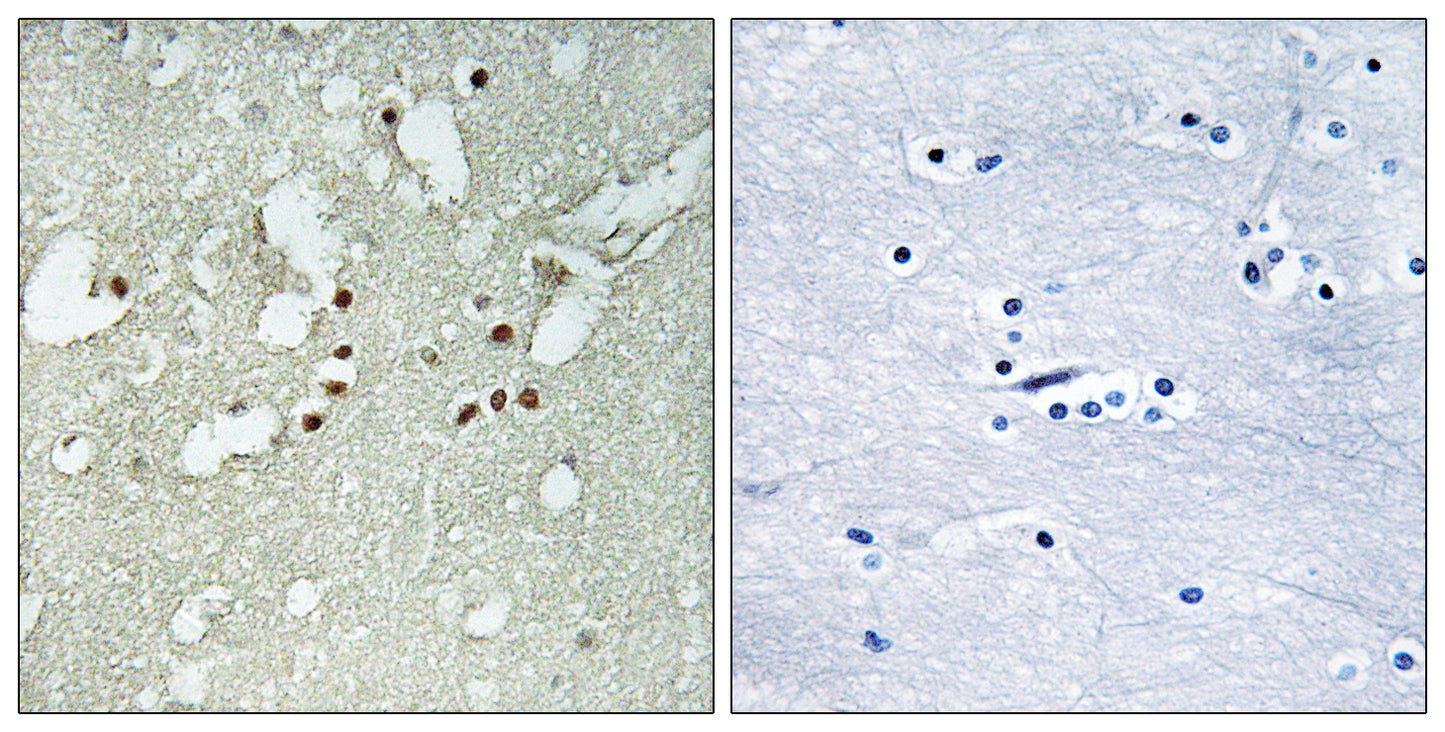 FoxJ3 Rabbit Polyclonal Antibody