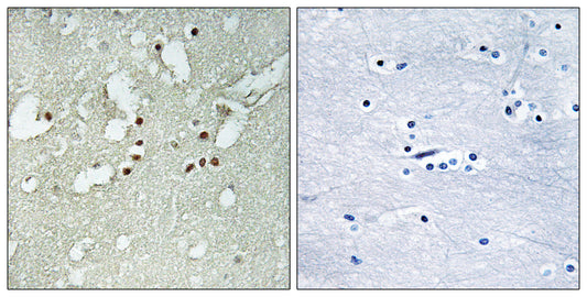 FoxJ3 Rabbit Polyclonal Antibody