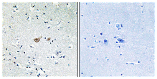 FoxO1 Rabbit Polyclonal Antibody