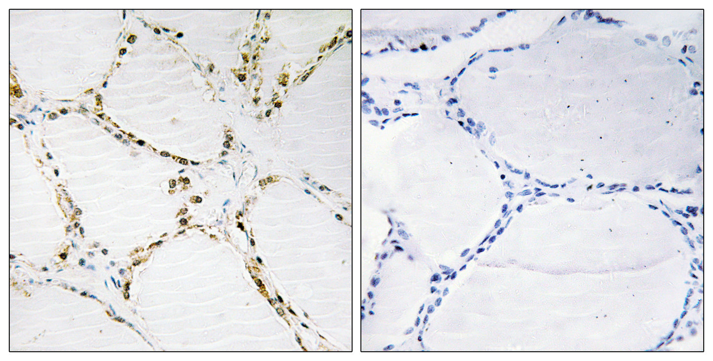 FoxO1/3 Rabbit Polyclonal Antibody