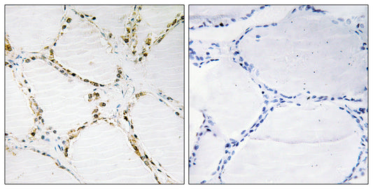 FoxO1/3 Rabbit Polyclonal Antibody