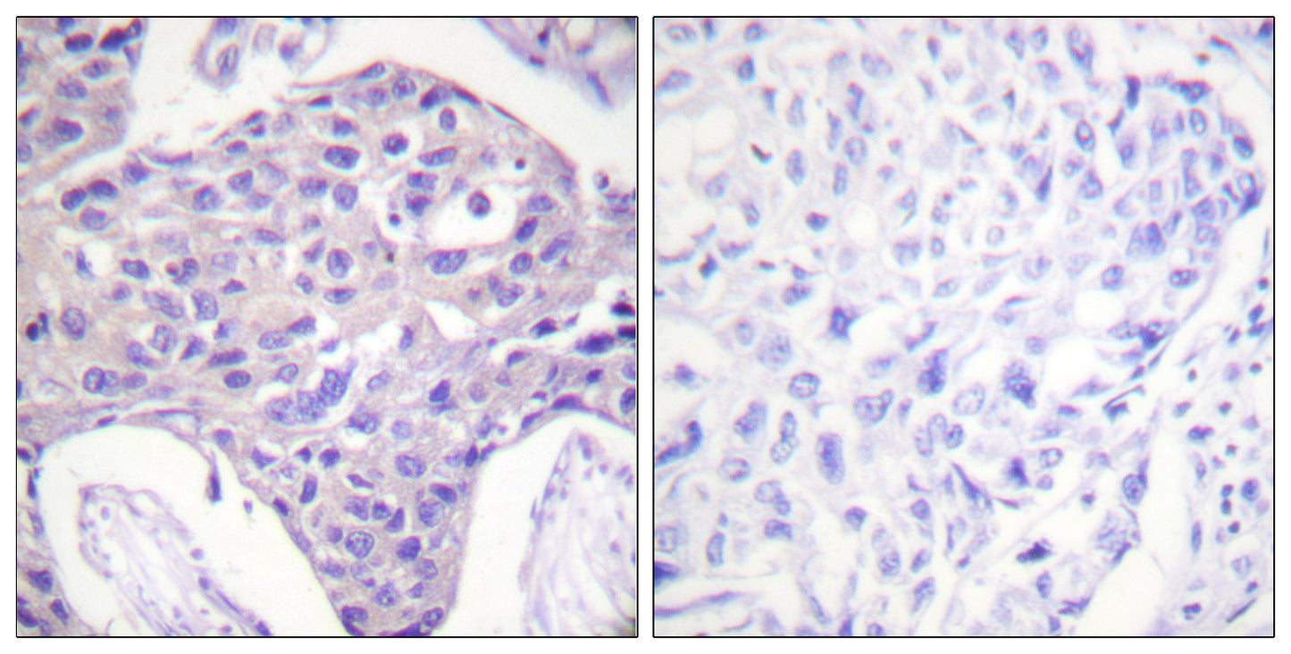 FoxO1/3/4 Rabbit Polyclonal Antibody